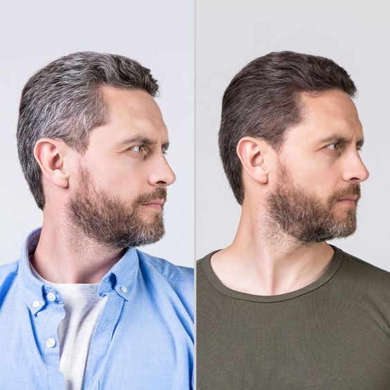 Instant Hair Dye Comb Stick – Quick & Natural Gray Coverage for Men & Women