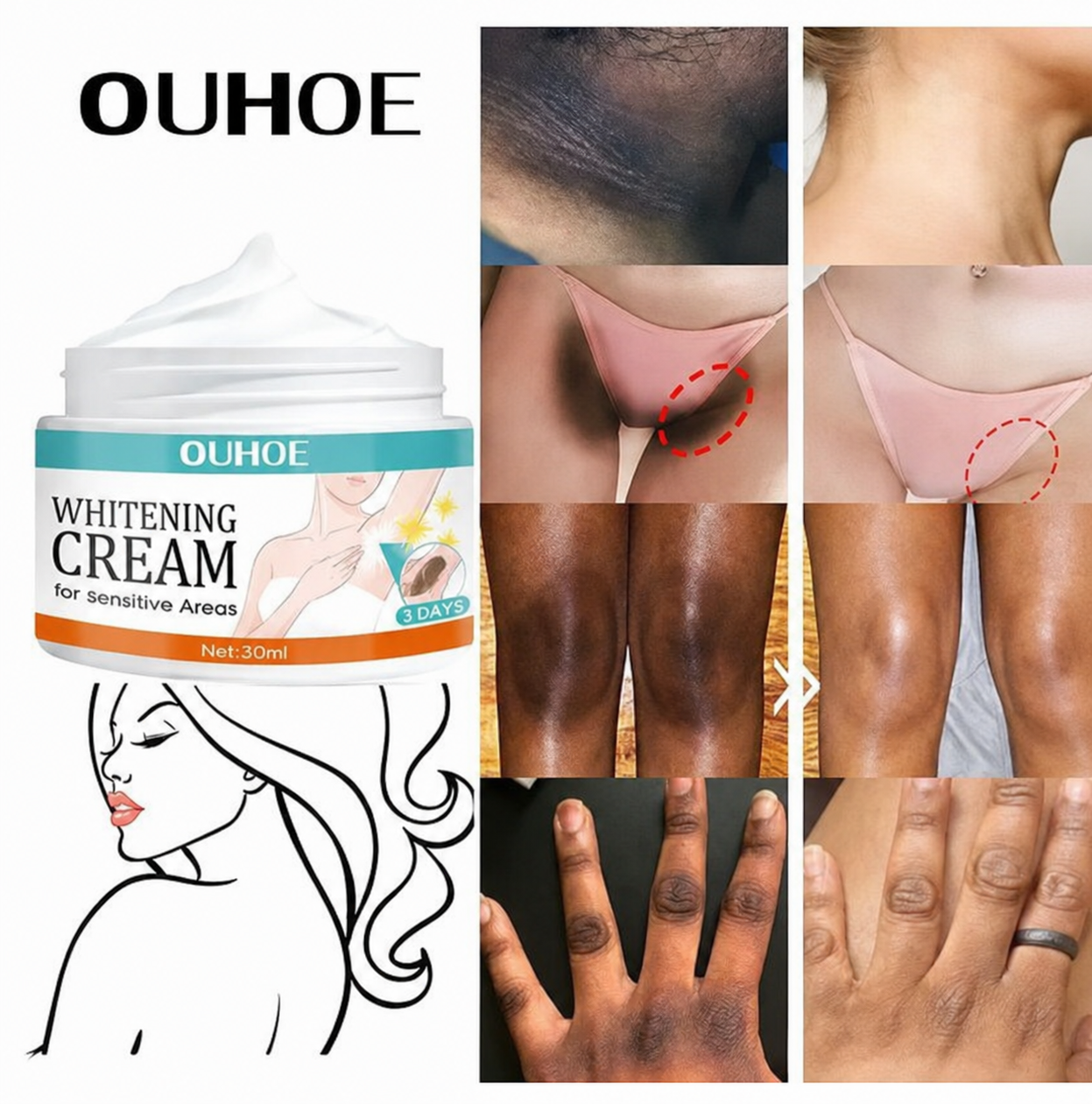 Sensitive Area Brightening Cream for Underarms & Private Areas | For Men & Women