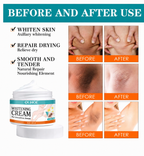 Sensitive Area Brightening Cream for Underarms & Private Areas | For Men & Women